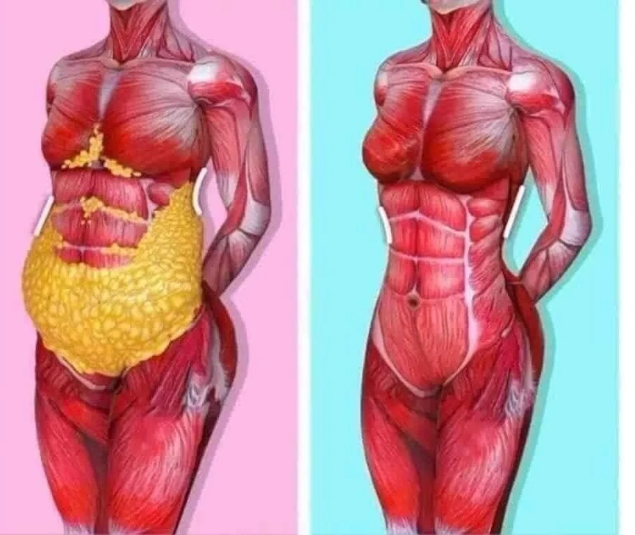 TÍCH MỠ NỘI TẠNG: NGUY HIỂM HƠN BẠN NGHĨ VÀ CÁCH GIẢM TỰ NHIÊN, BỀN VỮNG